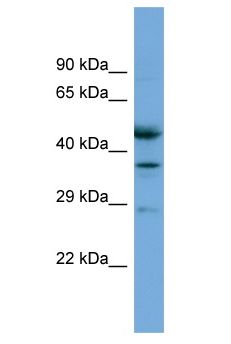 ETFB Antibody - ETFB antibody Western Blot of COLO205. Antibody dilution: 1 ug/ml.  This image was taken for the unconjugated form of this product. Other forms have not been tested.