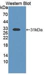 ETFB Antibody - Western blot of ETFB antibody.