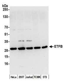 ETFB Antibody - Detection of human and mouse ETFB by western blot. Samples: Whole cell lysate (50 µg) from HeLa, HEK293T, Jurkat, mouse TCMK-1, and mouse NIH 3T3 cells prepared using NETN lysis buffer. Antibody: Affinity purified rabbit anti-ETFB antibody used for WB at 0.1 µg/ml. Detection: Chemiluminescence with an exposure time of 10 seconds.