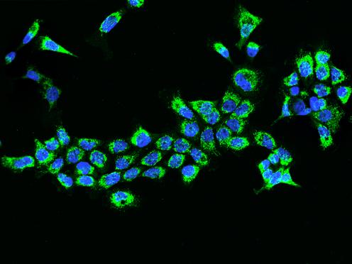 ETFB Antibody - Immunofluorescence staining of ETFB in A431 cells. Cells were fixed with 4% PFA, permeabilzed with 0.1% Triton X-100 in PBS, blocked with 10% serum, and incubated with rabbit anti-Human ETFB polyclonal antibody (dilution ratio 1:200) at 4°C overnight. Then cells were stained with the Alexa Fluor 488-conjugated Goat Anti-rabbit IgG secondary antibody (green) and counterstained with DAPI (blue). Positive staining was localized to Cytoplasm.