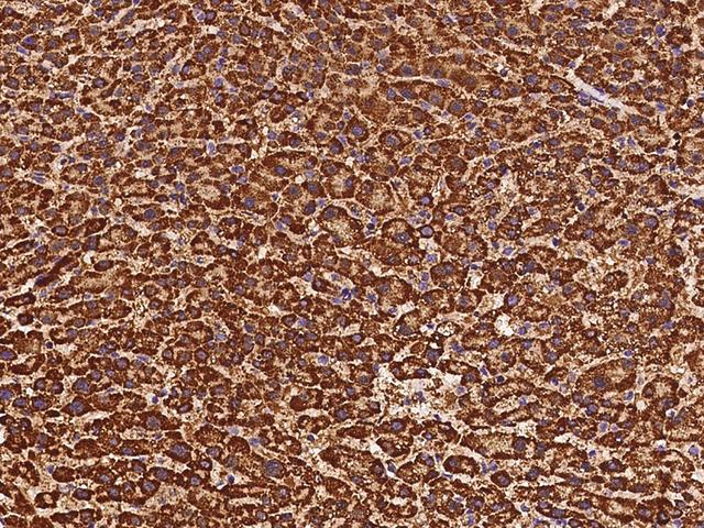 ETFB Antibody - Immunochemical staining of human ETFB in human liver with rabbit polyclonal antibody at 1:500 dilution, formalin-fixed paraffin embedded sections.