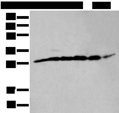ETFB Antibody - Western blot analysis of PC-3 cell mouse skeletal muscle tissue mouse brain tissue human heart tissue Hela and HEPG2 cell lysates  using ETFB Polyclonal Antibody at dilution of 1:400