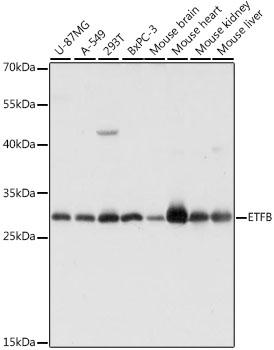 ETFB Antibody - Western blot analysis of extracts of various cell lines using ETFB Polyclonal Antibody at dilution of 1:1000.