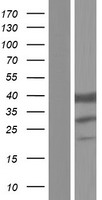 ETFB Protein - Western validation with an anti-DDK antibody * L: Control HEK293 lysate R: Over-expression lysate