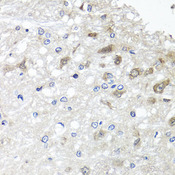 ETFBKMT Antibody - Immunohistochemistry of paraffin-embedded rat brain tissue.