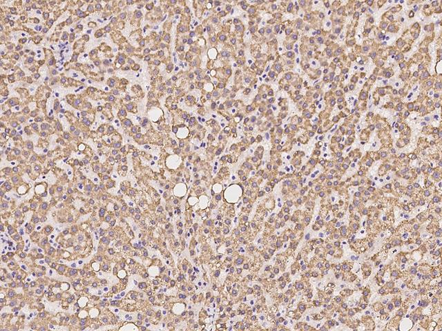 ETFBKMT Antibody - Immunochemical staining of human C12orf72 in human liver with rabbit polyclonal antibody at 1:100 dilution, formalin-fixed paraffin embedded sections.