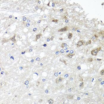ETFBKMT Antibody - Immunohistochemistry of paraffin-embedded Rat brain using METTL20 Polyclonal Antibody at dilution of 1:100 (40x lens).