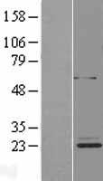 ETFBKMT Protein - Western validation with an anti-DDK antibody * L: Control HEK293 lysate R: Over-expression lysate
