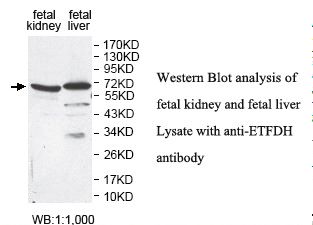 ETFDH Antibody