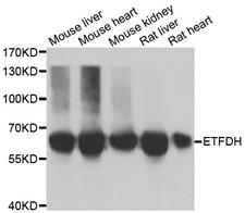 ETFDH Antibody - Western blot analysis of extracts of various cell lines.