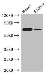ETFDH Antibody - Western Blot Positive WB detected in: Mouse heart tissue, Mouse kidney tissue All lanes: ETFDH antibody at 3µg/ml Secondary Goat polyclonal to rabbit IgG at 1/50000 dilution Predicted band size: 69, 63 kDa Observed band size: 69 kDa