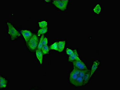 ETFDH Antibody - Immunofluorescent analysis of PC3 cells diluted at 1:100 and Alexa Fluor 488-congugated AffiniPure Goat Anti-Rabbit IgG(H+L)