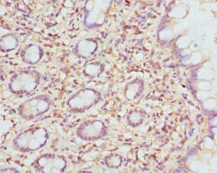 ETFDH Antibody - Immunohistochemistry of paraffin-embedded human small intestine at dilution 1:100