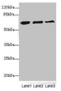 ETFDH Antibody - Western blot All Lanes: ETFDHantibody at 3.56ug/ml Lane 1 : Mouse liver tissue Lane 2 : Mouse kidney tissue Lane 3 : 293T whole cell lysate Secondary Goat polyclonal to Rabbit IgG at 1/10000 dilution Predicted band size: 69,63 kDa Observed band size: 68 kDa