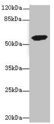 ETFDH Antibody - Western blot All lanes: ETFDH antibody at 3.56µg/ml + 293T whole cell lysate Secondary Goat polyclonal to rabbit IgG at 1/10000 dilution Predicted band size: 69, 63 kDa Observed band size: 63 kDa