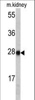 ETHE1 Antibody - Western blot of ETHE1 antibody in mouse kidney tissue lysates (35 ug/lane). ETHE1 (arrow) was detected using the purified antibody.