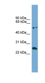 ETHE1 Antibody - ETHE1 antibody Western blot of COLO205 cell lysate. This image was taken for the unconjugated form of this product. Other forms have not been tested.