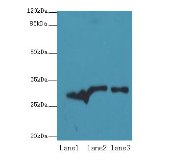 ETHE1 Antibody - Western blot. All lanes: ETHE1 antibody at 8 ug/ml. Lane 1: Mouse liver tissue. Lane 2: HepG-2 whole cell lysate. Lane 3: HeLa whole cell lysate. Secondary Goat polyclonal to Rabbit IgG at 1:10000 dilution. Predicted band size: 28 kDa. Observed band size: 28 kDa.