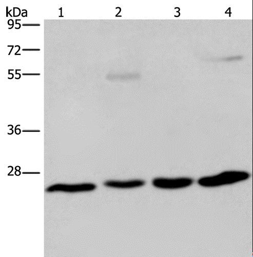 ETHE1 Antibody - Western blot analysis of A549 cell and human hepatocellular carcinoma, mouse liver tissue and HT-29 cell, using ETHE1 Polyclonal Antibody at dilution of 1:400.