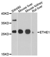 ETHE1 Antibody - Western blot analysis of extracts of various cell lines, using ETHE1 antibody at 1:1000 dilution. The secondary antibody used was an HRP Goat Anti-Rabbit IgG (H+L) at 1:10000 dilution. Lysates were loaded 25ug per lane and 3% nonfat dry milk in TBST was used for blocking. An ECL Kit was used for detection and the exposure time was 90s.