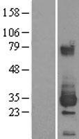 ETHE1 Protein - Western validation with an anti-DDK antibody * L: Control HEK293 lysate R: Over-expression lysate
