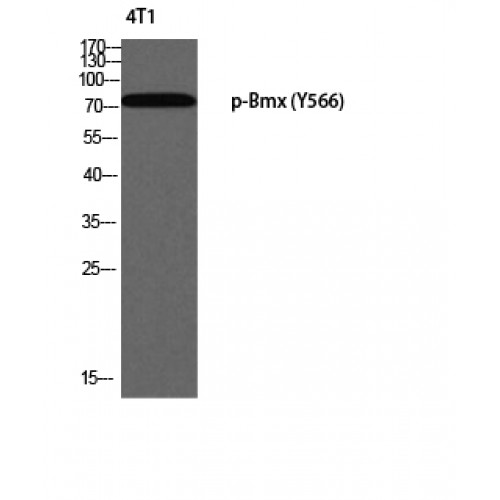 ETK / BMX Antibody - Western blot of Phospho-Bmx (Y566) antibody
