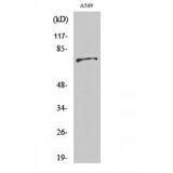 ETK / BMX Antibody - Western blot of Bmx antibody