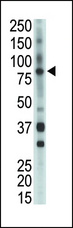 ETK / BMX Antibody - The anti-BMX antibody is used in Western blot to detect BMX in mouse heart tissue lysate.