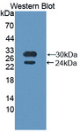 ETK / BMX Antibody - Western blot of ETK / BMX antibody.