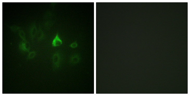 ETK / BMX Antibody - Immunofluorescence analysis of A549 cells, using ETK Antibody. The picture on the right is blocked with the synthesized peptide.