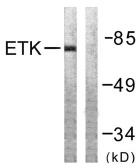 ETK / BMX Antibody - Western blot analysis of lysates from A549 cells, using ETK Antibody. The lane on the right is blocked with the synthesized peptide.