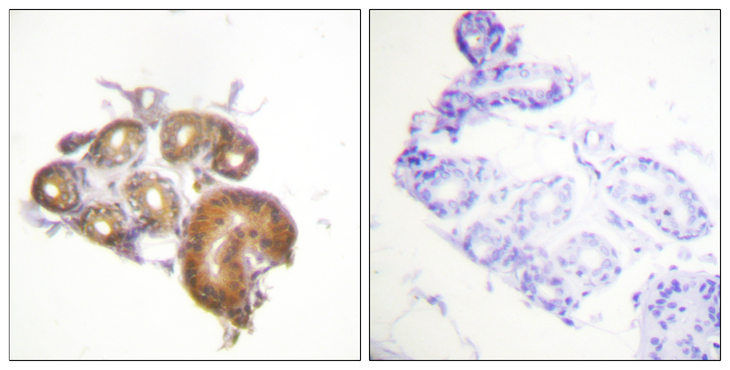 ETK / BMX Antibody - Immunohistochemistry analysis of paraffin-embedded human skin tissue, using ETK Antibody. The picture on the right is blocked with the synthesized peptide.