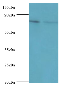 ETK / BMX Antibody - Western blot. All lanes: Cytoplasmic tyrosine-protein kinase BMX antibody at 4 ug/ml. Lane 1: A549 whole cell lysate. Lane 2: mouse heart tissue. Secondary antibody: Goat polyclonal to rabbit at 1:10000 dilution. Predicted band size: 78 kDa. Observed band size: 78 kDa Immunohistochemistry.