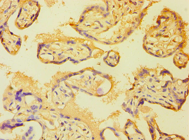 ETK / BMX Antibody - Immunohistochemistry of paraffin-embedded human placenta tissue using antibody at 1:100 dilution.