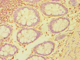 ETK / BMX Antibody - Immunohistochemistry of paraffin-embedded human colon tissue using BMX Antibody at dilution of 1:100