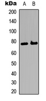 ETK / BMX Antibody - Western blot analysis of BMX expression in A549 (A); HeLa (B) whole cell lysates.