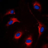 ETK / BMX Antibody - Immunofluorescent analysis of BMX staining in HeLa cells. Formalin-fixed cells were permeabilized with 0.1% Triton X-100 in TBS for 5-10 minutes and blocked with 3% BSA-PBS for 30 minutes at room temperature. Cells were probed with the primary antibody in 3% BSA-PBS and incubated overnight at 4 ??C in a humidified chamber. Cells were washed with PBST and incubated with a DyLight 594-conjugated secondary antibody (red) in PBS at room temperature in the dark. DAPI was used to stain the cell nuclei (blue).