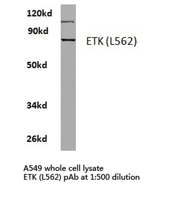 ETK / BMX Antibody - Western blot of ETK (L562) pAb in extracts from A549 cells.