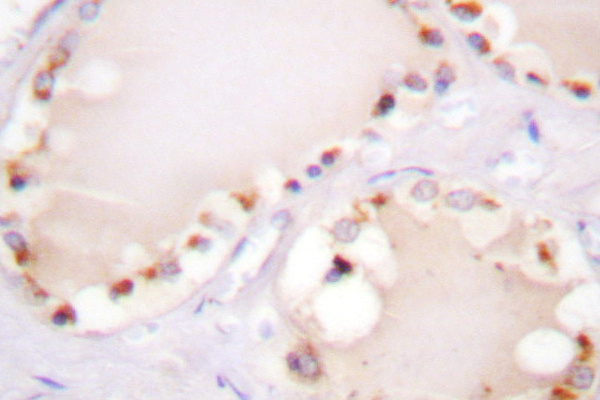 ETK / BMX Antibody - IHC of ETK (L562) pAb in paraffin-embedded human skin tissue.