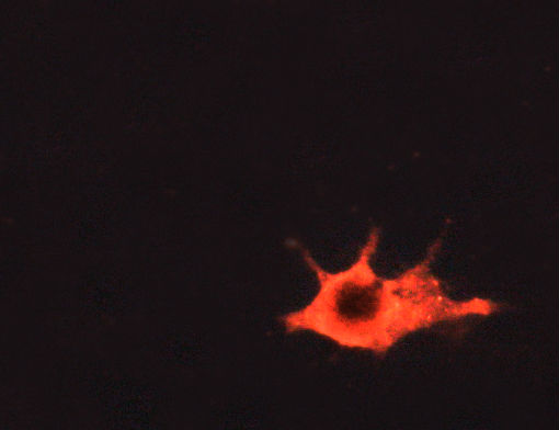 ETK / BMX Antibody - IF analysis of A549 cells using 1:500-1:1000