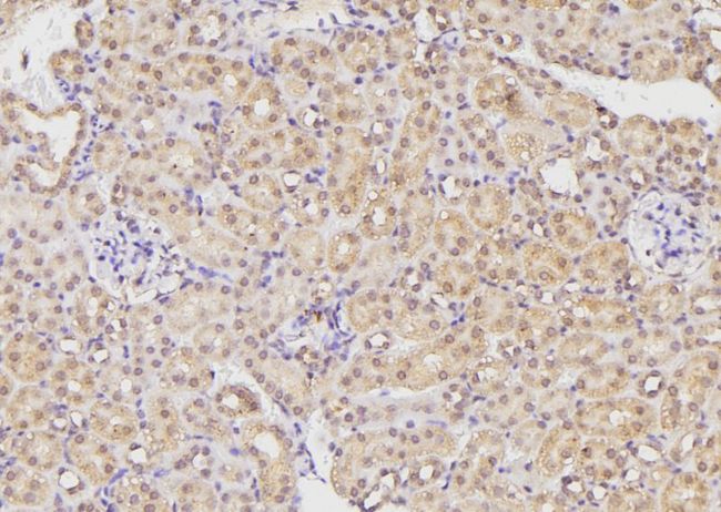 ETK / BMX Antibody - 1:100 staining mouse kidney tissue by IHC-P. The sample was formaldehyde fixed and a heat mediated antigen retrieval step in citrate buffer was performed. The sample was then blocked and incubated with the antibody for 1.5 hours at 22°C. An HRP conjugated goat anti-rabbit antibody was used as the secondary.