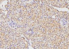 ETK / BMX Antibody - 1:100 staining mouse kidney tissue by IHC-P. The sample was formaldehyde fixed and a heat mediated antigen retrieval step in citrate buffer was performed. The sample was then blocked and incubated with the antibody for 1.5 hours at 22°C. An HRP conjugated goat anti-rabbit antibody was used as the secondary.