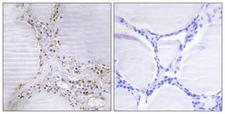 ETK / BMX Antibody - Peptide - + Immunohistochemistry analysis of paraffin-embedded human thyroid gland tissue using BMX antibody.