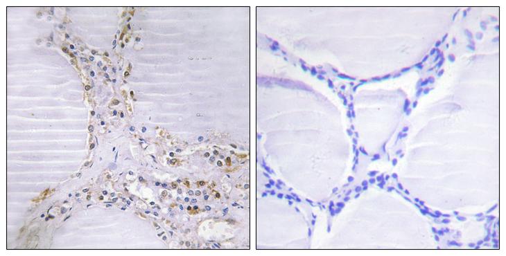 ETK / BMX Antibody - Peptide - + Immunohistochemistry analysis of paraffin-embedded human thyroid gland tissue using BMX antibody.