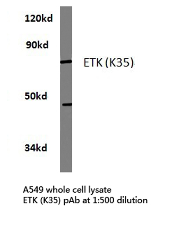 ETK / BMX Antibody - Western blot of ETK (K35) pAb in extracts from A549 cells.