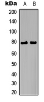 ETK / BMX Antibody - Western blot analysis of BMX expression in A549 (A); DU145 (B) whole cell lysates.