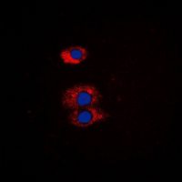 ETK / BMX Antibody - Immunofluorescent analysis of BMX staining in DU145 cells. Formalin-fixed cells were permeabilized with 0.1% Triton X-100 in TBS for 5-10 minutes and blocked with 3% BSA-PBS for 30 minutes at room temperature. Cells were probed with the primary antibody in 3% BSA-PBS and incubated overnight at 4 ??C in a humidified chamber. Cells were washed with PBST and incubated with a DyLight 594-conjugated secondary antibody (red) in PBS at room temperature in the dark. DAPI was used to stain the cell nuclei (blue).