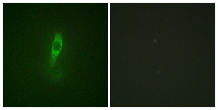 ETK / BMX Antibody - Immunofluorescence analysis of NIH/3T3 cells, using ETK (Phospho-Tyr40) Antibody. The picture on the right is blocked with the phospho peptide.