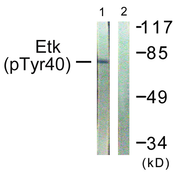ETK / BMX Antibody - Western blot analysis of lysates from HepG2 cells, using ETK (Phospho-Tyr40) Antibody. The lane on the right is blocked with the phospho peptide.