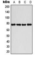 ETK / BMX Antibody - Western blot analysis of BMX (pY40) expression in MCF7 IL1b-treated (A); Jurkat CD3-treated (B); Raw264.7 IL1b-treated (C); H9C2 IL1b-treated (D) whole cell lysates.
